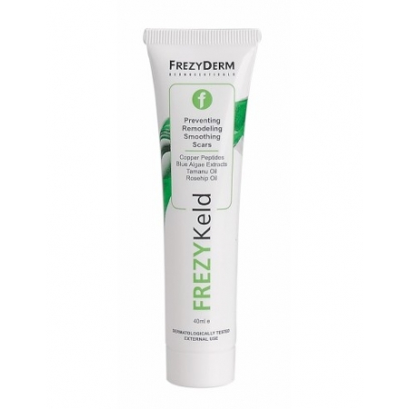 Frezyderm Frezykeld Cream Απαλή Κρέμα Αντιμετώπισης Ουλών, 40ml